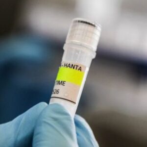 organismo-sanitario-investiga-el-hantavirus-afectado-por-nuevos-recortes-presupuestarios-de-milei