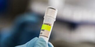 Organismo sanitario investiga el hantavirus afectado por nuevos recortes presupuestarios de Milei organismo-sanitario-investiga-el-hantavirus-afectado-por-nuevos-recortes-presupuestarios-de-milei