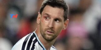 Qué le pasó a Lionel Messi en el ojo derecho durante el partido contra Suiza que-le-paso-a-lionel-messi-en-el-ojo-derecho-durante-el-partido-contra-suiza