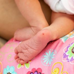 fenilcetonuria:-los-desafios-persistentes-y-las-nuevas-alternativas