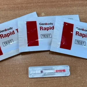 hantavirus:-uach-desarrolla-anticuerpos-y-entrega-5-mil-tests-rapidos