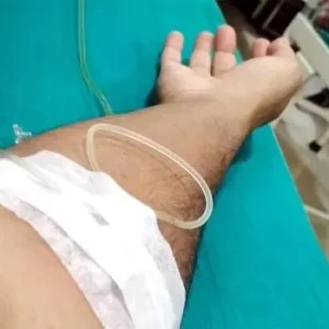 investigan-ataque-con-cuchillo-a-joven-en-la-paz