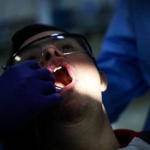 saliva-pode-dar-pistas-sobre-cancer-de-intestino